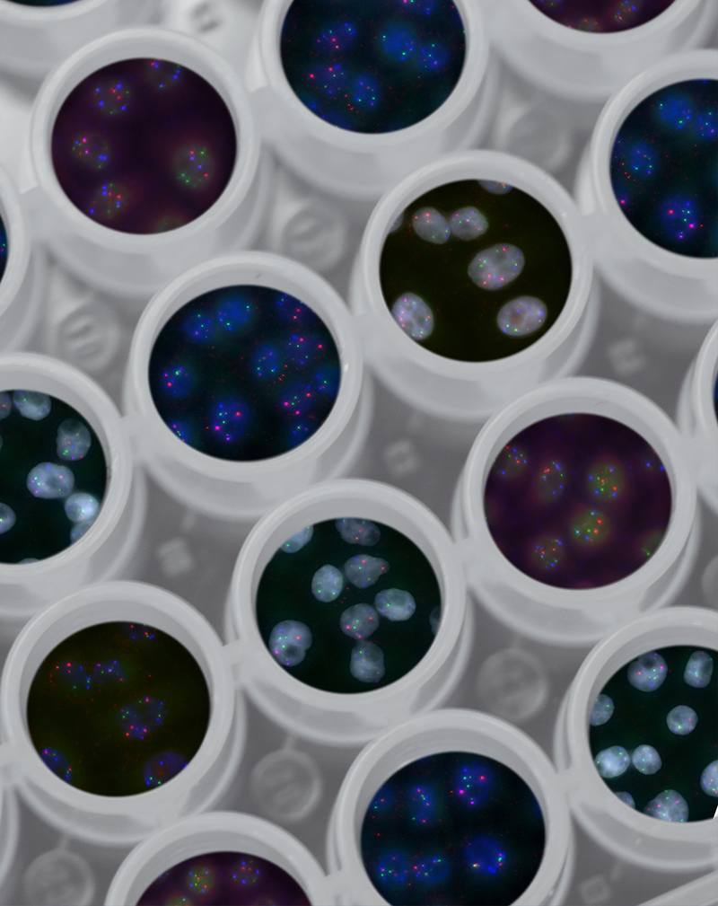 Petri dishes filled with samples