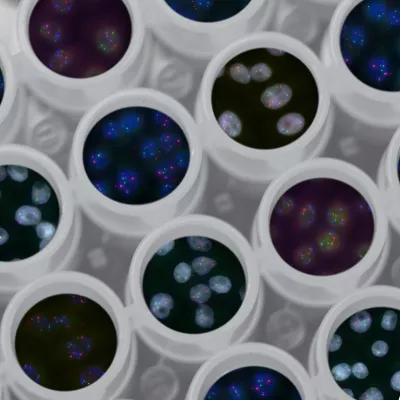 Petri dishes filled with samples